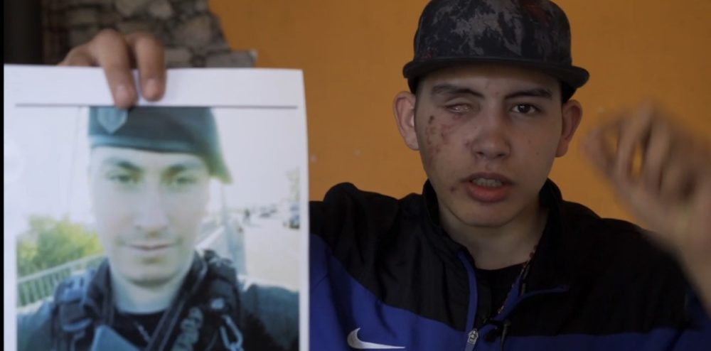 Liberan al policía que le disparó a un joven en Lomas de Zamora
