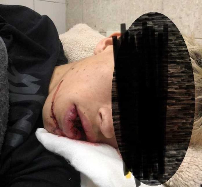El vicio patovica: Un pibe de 19 años fue salvajemente golpeado en Luján